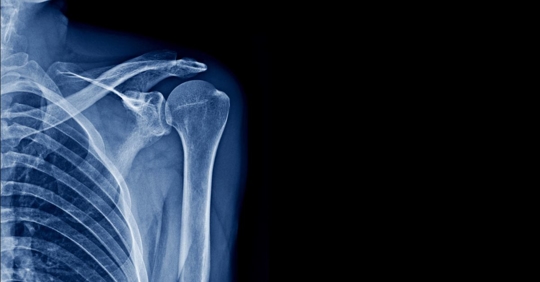 X-ray image of a skeleton.