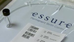 Essure contraceptive device